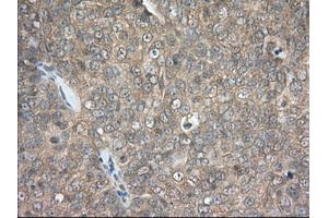 Immunohistochemical staining of paraffin-embedded Human colon tissue using anti-PDE4A mouse monoclonal antibody. (PDE4A 抗体)
