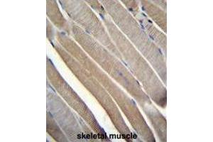 TRMT2B Antibody (N-term) immunohistochemistry analysis in formalin fixed and paraffin embedded human skeletal muscle followed by peroxidase conjugation of the secondary antibody and DAB staining. (TRMT2B 抗体  (N-Term))