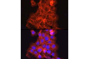 Immunohistochemistry (IHC) image for anti-Thrombomodulin (THBD) (AA 200-500) antibody (ABIN1683026)