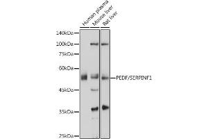 Western blot analysis of extracts of various cell lines, using PEDF/PEDF/SERPINF1 antibody (ABIN6131334, ABIN6147606, ABIN6147607 and ABIN6215471) at 1:1000 dilution. (PEDF 抗体  (AA 1-200))