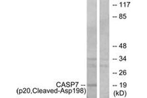Western blot analysis of extracts from Jurkat cells, treated with etoposide 25uM 24h, using Caspase 7 (p20,Cleaved-Asp198) Antibody. (Caspase 7 抗体  (Cleaved-Asp198))