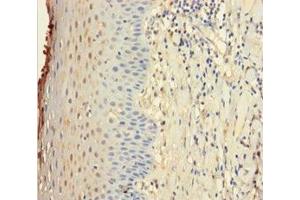Immunohistochemistry of paraffin-embedded human tonsil tissue using ABIN7156855 at dilution of 1:100 (IL22 Receptor alpha 1 抗体  (AA 250-573))