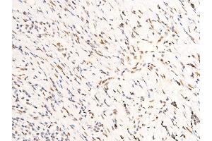 Immunohistochemistry (IHC) image for anti-Receptor tyrosine-protein kinase erbB-2 (ErbB2/Her2) (pTyr1248) antibody (ABIN6256630)