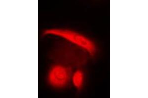 Immunofluorescent analysis of c-SRC staining in HuvEc cells. (Src 抗体  (C-Term))