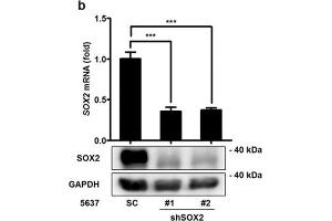 SOX2 mediates growth of bladder cancer cells. (SOX2 抗体)