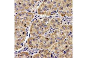 Immunohistochemical analysis of ANG staining in human liver formalin fixed paraffin embedded tissue section. (ANG 抗体  (N-Term))