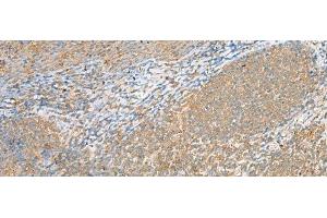 Immunohistochemistry of paraffin-embedded Human tonsil tissue using FOLR1 Polyclonal Antibody at dilution of 1:80(x200) (FOLR1 抗体)