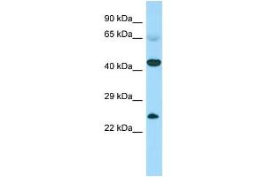 Host: Rabbit Target Name: CABS1 Sample Type: Fetal Heart lysates Antibody Dilution: 1. (CABS1 抗体  (N-Term))