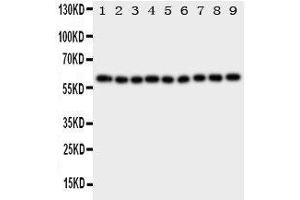 Western Blotting (WB) image for anti-Interleukin 5 Receptor, alpha (IL5RA) (AA 53-68), (N-Term) antibody (ABIN3043143)