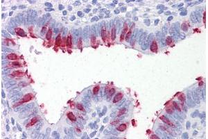 Human Uterus: Formalin-Fixed, Paraffin-Embedded (FFPE) (ARVCF 抗体  (AA 863-963))