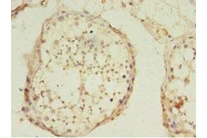 Immunohistochemistry of paraffin-embedded human testis tissue using ABIN7174332 at dilution of 1:100 (USP45 抗体  (C-Term))