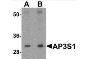 Western blot analysis of AP3S1 in mouse kidney tissue lysate with AP3S1 antibody at (A) 1 and (B) 2 μg/ml. (AP3S1 抗体  (Center))