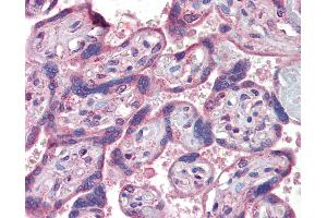 Anti-IFNAR2 antibody IHC of human placenta. (IFNAR2 抗体  (AA 28-40))