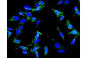 IF analysis of Inhibin alpha/INHA using anti-Inhibin alpha/INHA antibody (ABIN7600932). (Inhibin alpha 抗体  (AA 254-366))