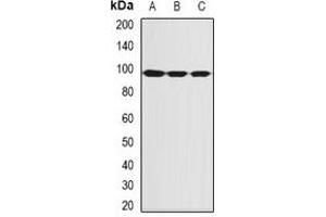 Western blot analysis of SBP-2 expression in MCF7 (A), Hela (B), mouse thymus (C) whole cell lysates. (SECISBP2 抗体)
