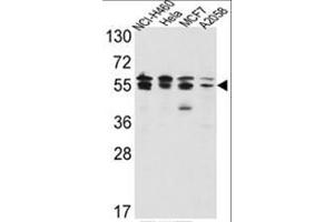 Western blot analysis of IMPDH2 Antibody (Center) in NCI-H460,Hela,MCF7,A2058 cell line lysates(35ug/lane). (IMPDH2 抗体  (Middle Region))
