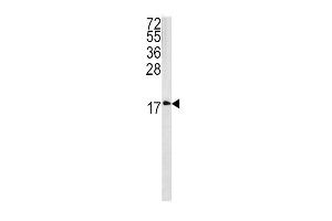Western blot analysis of CAV3 antibody (N-term) (ABIN390412 and ABIN2840801) in 293 cell line lysates (35 μg/lane). (Caveolin 3 抗体  (N-Term))