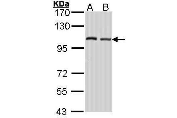EIF4G2 抗体  (C-Term)