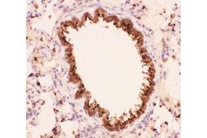 IHC-P: Annexin A1 antibody testing of rat lung tissue (Annexin a1 抗体  (AA 2-346))