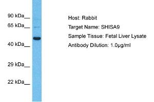 Host: Rabbit Target Name: SHISA9 Sample Type: Fetal Liver lysates Antibody Dilution: 1. (Shisa9 抗体  (Middle Region))
