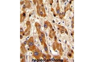 Immunohistochemistry (IHC) image for anti-BCL2-Associated X Protein (BAX) (BH3 Domain) antibody (ABIN2995215) (BAX 抗体  (BH3 Domain))