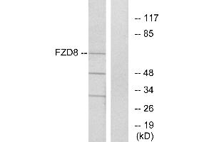 Western blot analysis of extracts from Jurkat cells, using FZD8 antibody. (FZD8 抗体  (Internal Region))