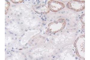 Detection of LCP1 in Human Kidney Tissue using Polyclonal Antibody to L-Plastin (LCP1)