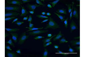 Immunofluorescence of monoclonal antibody to AKAP9 on HeLa cell. (AKAP9 抗体  (AA 3812-3911))