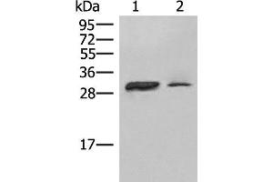 Western blot analysis of Raji cell Human spleen tissue lysates using HLA-DPA1 Polyclonal Antibody at dilution of 1:400 (HLA-DPA1 抗体)