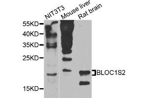 Western blot analysis of extracts of various cells, using BLOC1S2 antibody. (BLOC1S2 抗体)