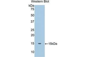 Detection of Recombinant Haptoglobin, Human using Polyclonal Antibody to Haptoglobin (Hpt) (Haptoglobin 抗体  (AA 44-157))