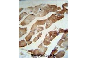 GSN Antibody (N-term) (R) IHC analysis in formalin fixed and paraffin embedded human Skeletal muscle tissue followed by peroxidase conjugation of the secondary antibody and DAB staining.