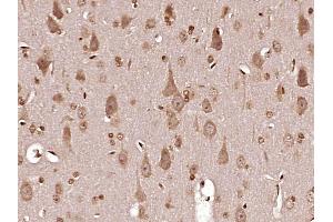 Paraformaldehyde-fixed, paraffin embedded Rat brain Antigen retrieval by boiling in sodium citrate buffer (pH6. (MT-ND6 抗体  (AA 51-150))
