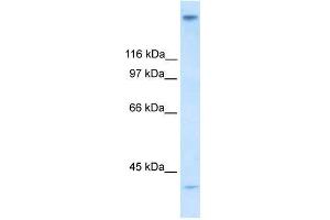 Human Stomach; WB Suggested Anti-ZNF318 Antibody Titration: 0. (ZNF318 抗体  (N-Term))