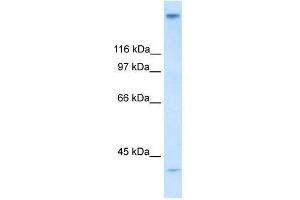 Human Stomach; WB Suggested Anti-ZNF318 Antibody Titration: 0. (ZNF318 抗体  (N-Term))