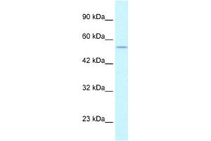 WB Suggested Anti-EGLN1 Antibody Titration:  1. (EGLN1 抗体  (C-Term))