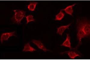 Immunofluorescence (fixed cells) (IF/ICC) image for anti-Olfactory Receptor, Family 13, Subfamily C, Member 8 (OR13C8) antibody (ABIN6263807)