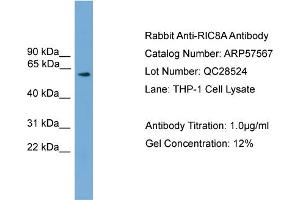 WB Suggested Anti-RIC8A  Antibody Titration: 0. (RIC8A 抗体  (N-Term))