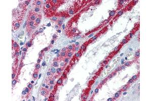 Immunohistochemistry (IHC) image for anti-ATPase, Na+/K+ Transporting, beta 1 Polypeptide (ATP1B1) (AA 201-250) antibody (ABIN6747090)