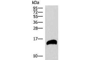 Western blot analysis of Human pancreas tissues lysate using REG1B Polyclonal Antibody at dilution of 1:800 (REG1B 抗体)