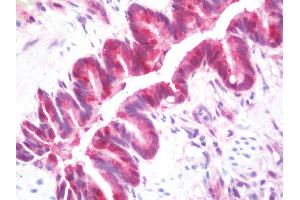 Anti-GSTT1 antibody IHC staining of human lung. (GSTT1 抗体  (AA 1-240))