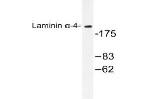 Western blot (WB) analysis of Laminin alpha-4 antibody in extracts from COLO cells. (LAMa4 抗体)
