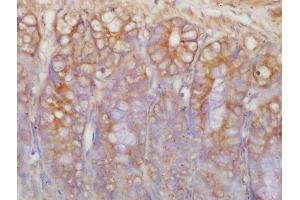 Formalin-fixed and paraffin embedded rat intestine labeled with Rabbit Anti-c-Kit Polyclonal Antibody, Unconjugated  at 1:200 followed by conjugation to the secondary antibody and DAB staining (KIT 抗体  (AA 350-440))