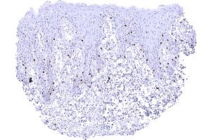 Scattered SOX10 positive melanocytes in the epidermis of the skin (Recombinant SOX10 抗体)