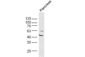 Mouse pancreas lysates probed with AKT1/3 Polyclonal Antibody, unconjugated  at 1:300 overnight at 4°C followed by a conjugated secondary antibody at 1:10000 for 90 minutes at 37°C. (AKT1/3 (AA 401-479) 抗体)