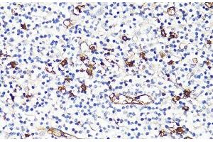 Immunohistochemistry (Paraffin-embedded Sections) (IHC (p)) image for anti-S100 Calcium Binding Protein A9 (S100A9) antibody (ABIN7264896)