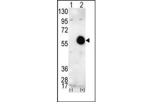 Western blot analysis of AKT2 (arrow) using AKT2 Antibody (AKT2 抗体  (C-Term))