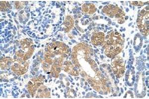 Immunohistochemical staining (Formalin-fixed paraffin-embedded sections) of human kidney with FAH polyclonal antibody  at 4-8 ug/mL working concentration. (FAH 抗体  (C-Term))