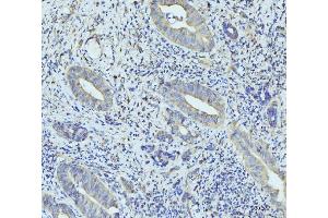 IHC analysis of RPL23 using anti-RPL23 antibody (ABIN7599808). (RPL23 抗体  (AA 12-136))