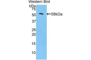 Western blot analysis of the recombinant protein. (MYH1 抗体  (AA 1585-1642))